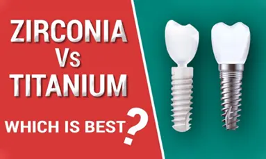 Guide to metallic or non-metallic implants